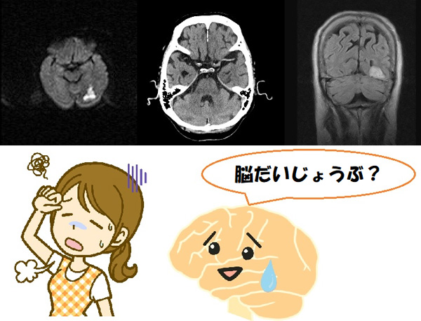 ちょっと気になる画像講座 脳梗塞ってどこ見ればわかるの 心臓弁膜症 手術 みどり病院 神戸市西区