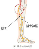 腓骨神経麻痺について～リハビリテーションと日常生活上での注意点～ – 医療法人社団倫生会 みどり病院 | 神戸市西区